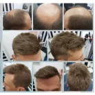 1, PEPI, TOUPEE FÉRFIAK RÉSZÉRE, SZUPER VÉKONY ALAP, 20x25 cm.-es, méretre vágható!