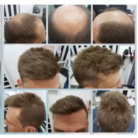 1, PEPI, TOUPEE FÉRFIAK RÉSZÉRE, SZUPER VÉKONY ALAP, 20x25 cm.-es, méretre vágható!